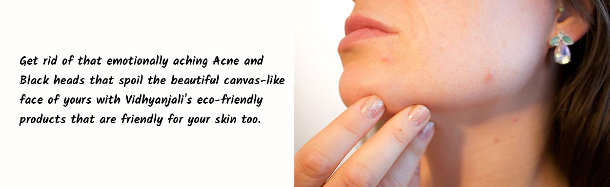 Acne Black head removal