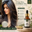 Anti Acne Face Serum - 15 ML