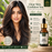 Anti Acne Face Serum - 15 ML